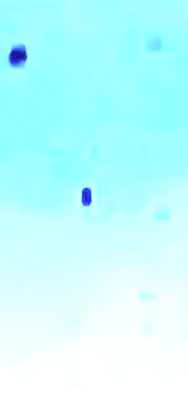 November 2025 heavily processed inverted-style render with the cloud field reduced to pale cyan and individual dark particles isolated as discrete deep-blue blobs to aid visual inspection of their shape and spacing